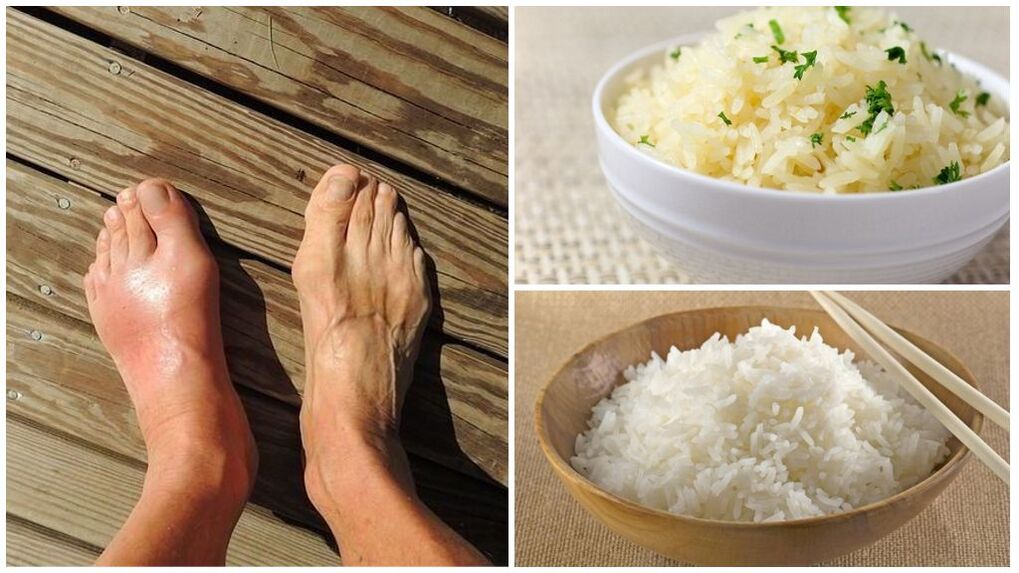 Eng Reis-baséiert Ernährung ass fir Goutpatienten recommandéiert. 